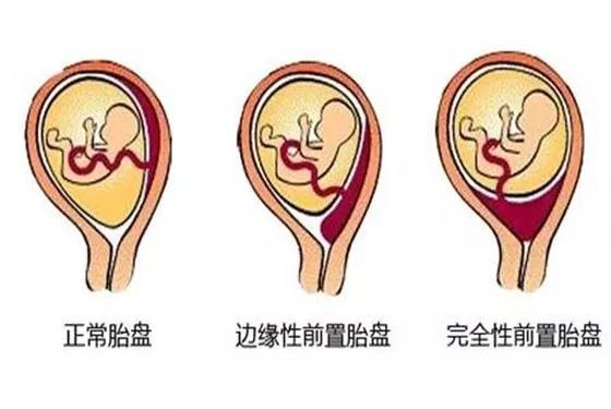 成都产科医院哪家好