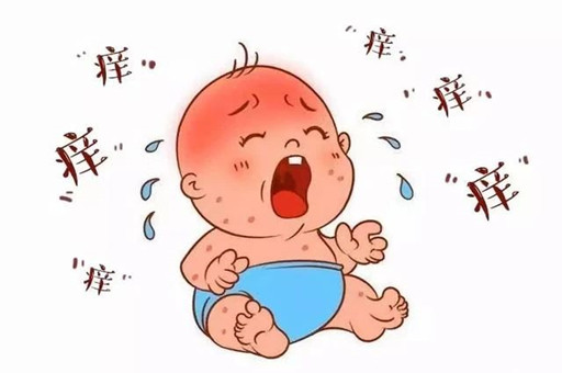 夏季宝宝湿疹反复怎么办？宝宝湿疹怎么护理？